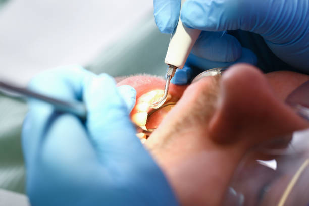 Best Emergency Dental Care for Trauma or Injury in Perry, OK