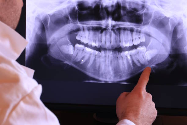 Best Emergency Dental Care for Trauma or Injury in Perry, OK