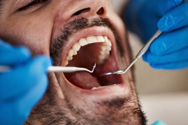 Best Weekend Emergency Dentist in Perry, OK